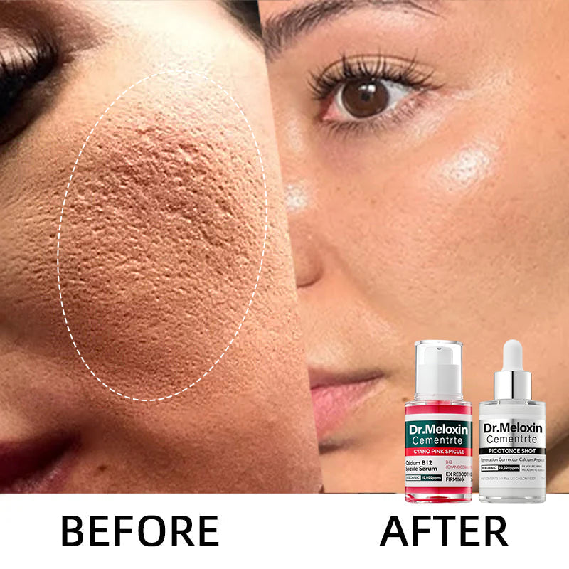 💥Shrinks Pores & Fades Blemish Marks in 2 Weeks | Cyano Pink Spicule Serum+ Picotonic Shot Ampoule
