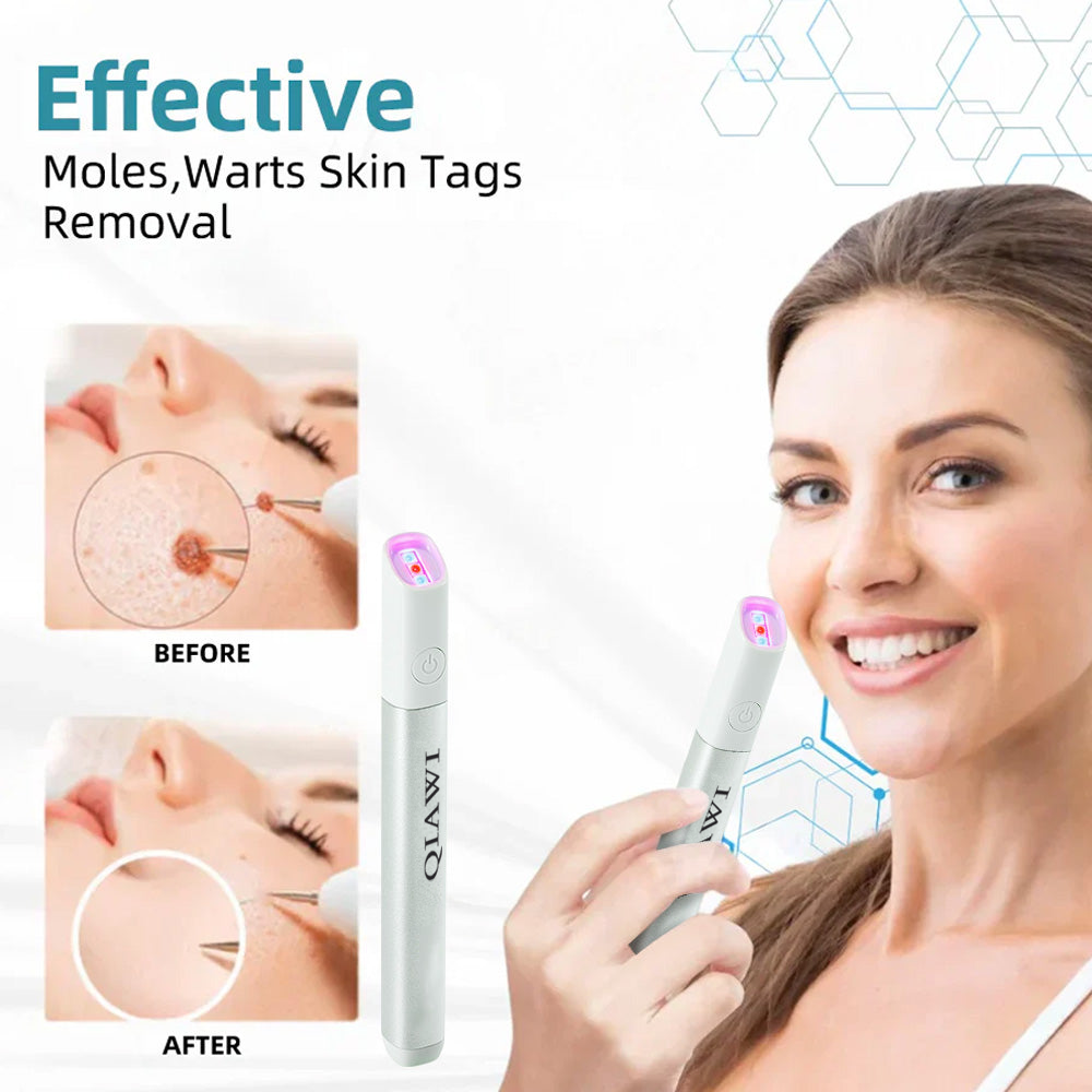 ✨ QIAWI™ CO₂ Laser Pen | Professional-Grade Skin Treatment for Moles, Warts, and Dark Spots