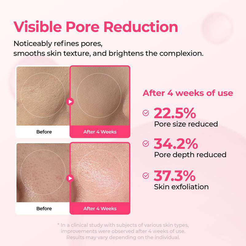 💥Shrinks Pores & Fades Blemish Marks in 2 Weeks | Cyano Pink Spicule Serum+ Picotonic Shot Ampoule