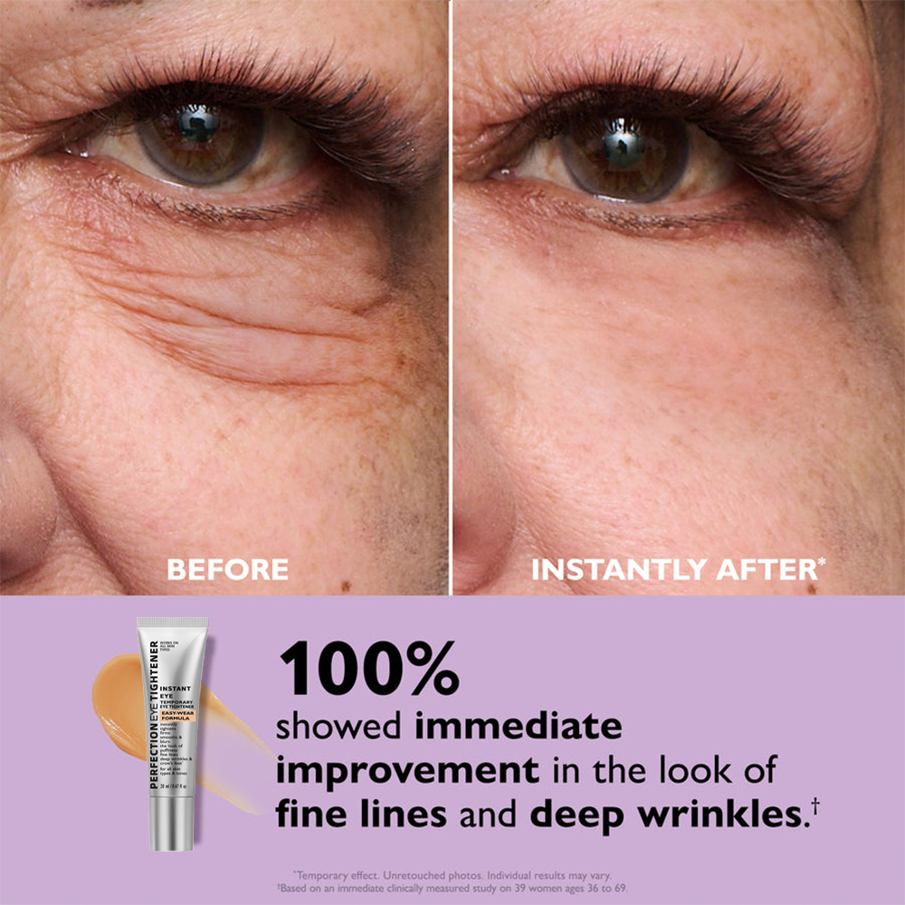 Last Chance! 70% OFF 🔥 Instant Eye Tightener – Smooth Formula + Free Brush Included!