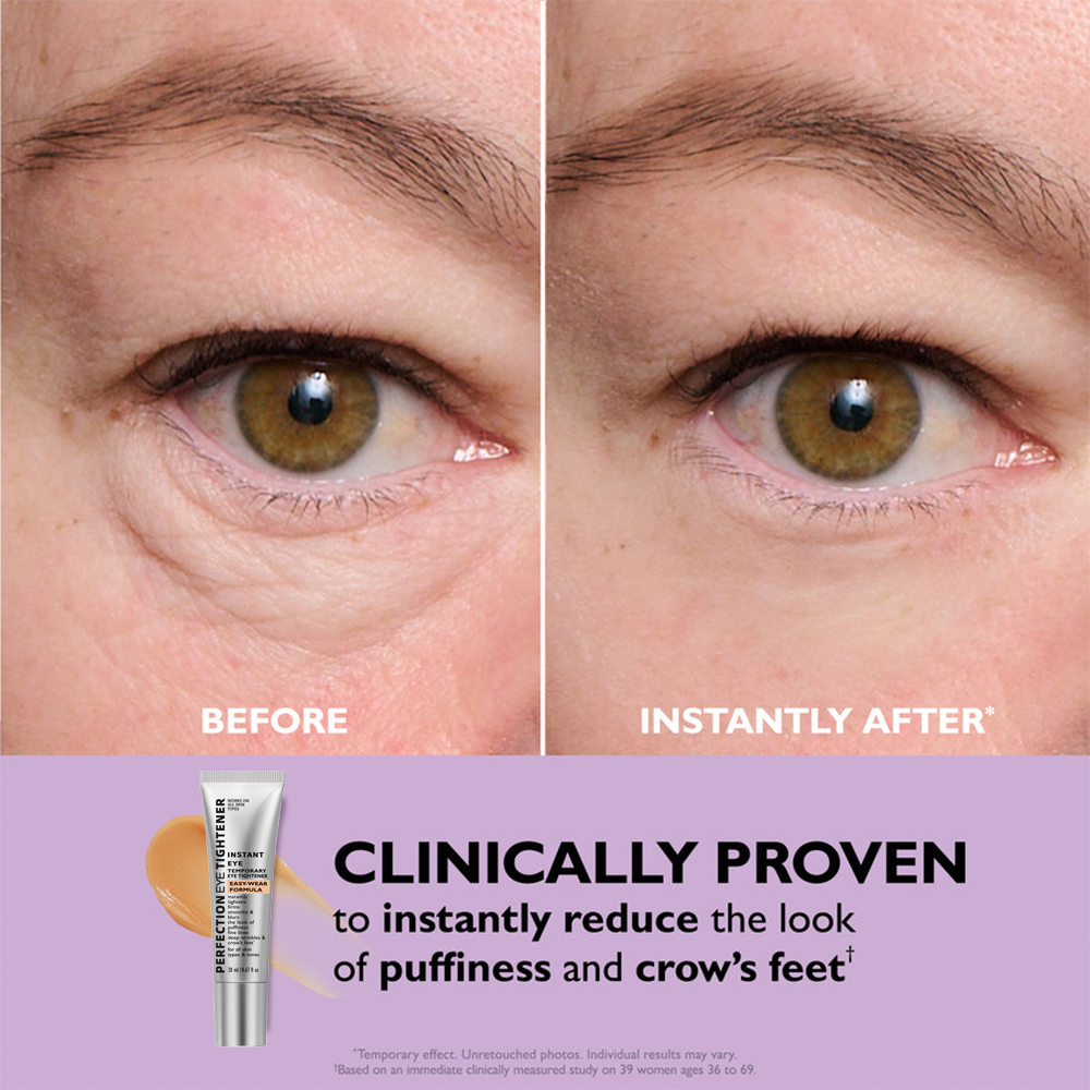 Last Chance! 70% OFF 🔥 Instant Eye Tightener – Smooth Formula + Free Brush Included!