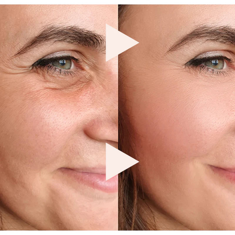The Express Anti-Wrinkle – Instant Lifting Effect-