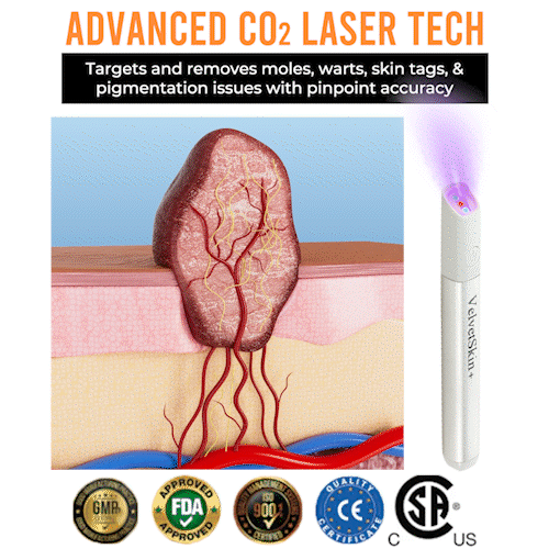 ✨ QIAWI™ CO₂ Laser Pen | Professional-Grade Skin Treatment for Moles, Warts, and Dark Spots