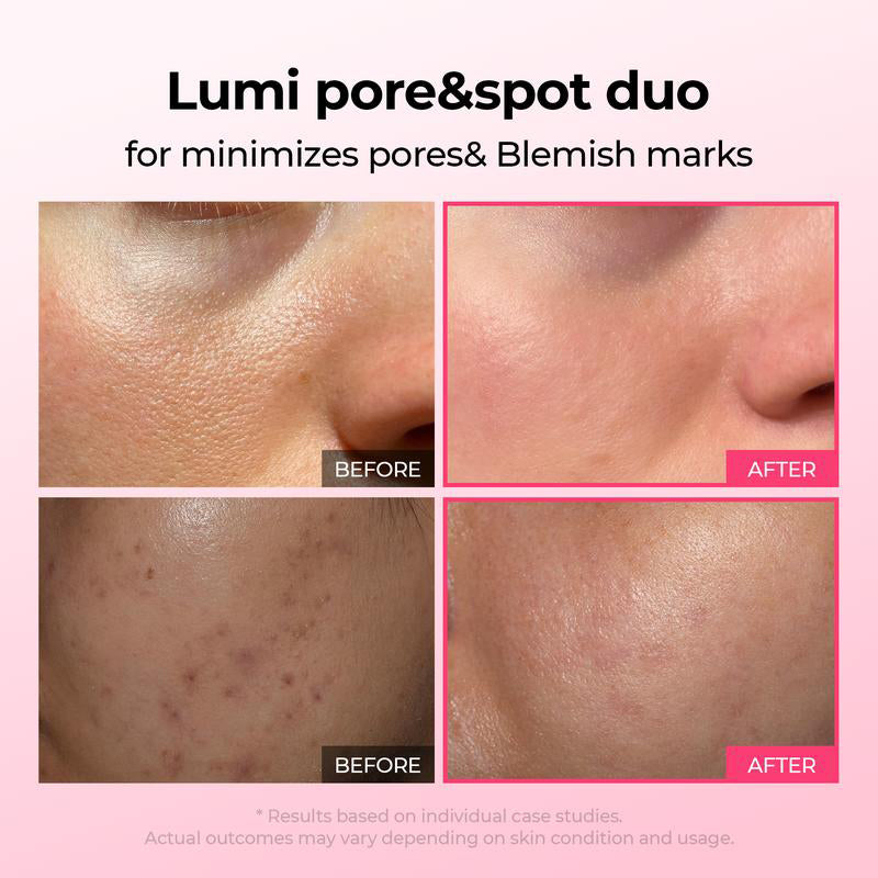 💥Shrinks Pores & Fades Blemish Marks in 2 Weeks | Cyano Pink Spicule Serum+ Picotonic Shot Ampoule