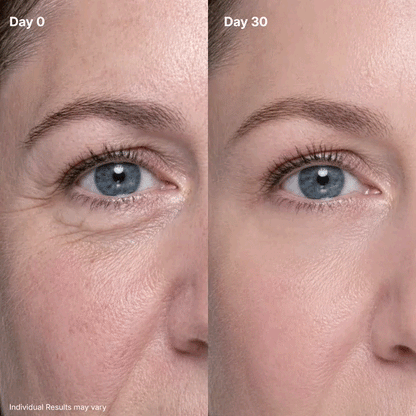 💖Trusted-by-over-50-000-women💖 Eye Renewal Cream