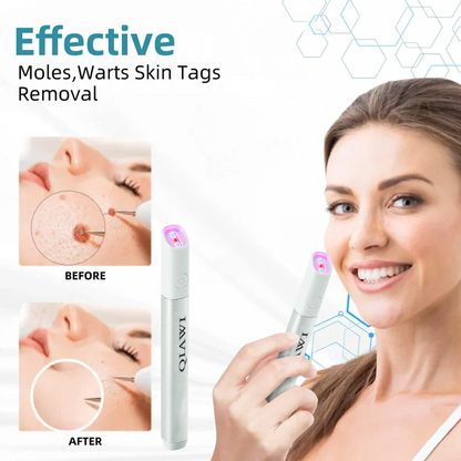 ✨ QIAWI™ CO₂ Laser Pen | Professional-Grade Skin Treatment for Moles, Warts, and Dark Spots
