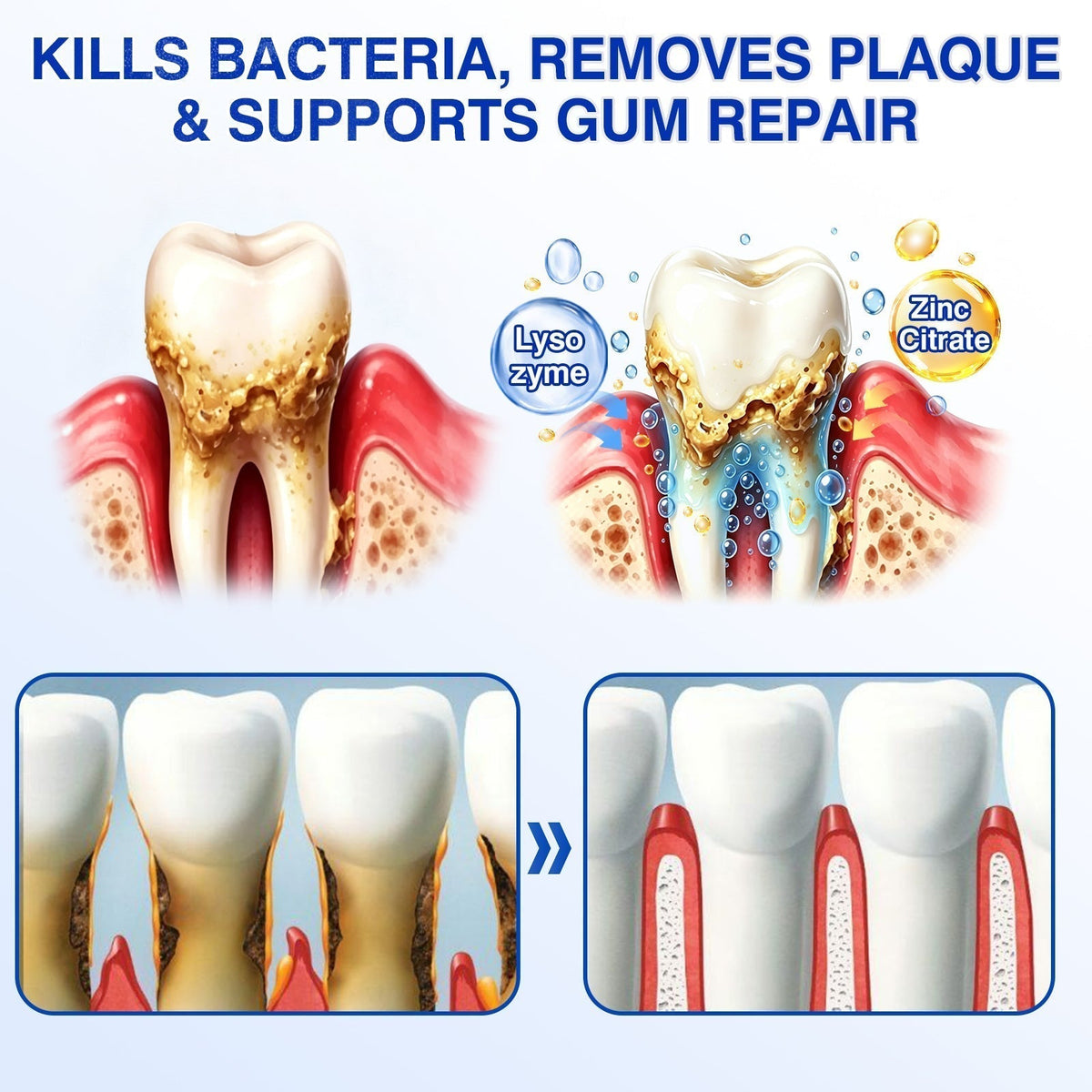 👨‍⚕️🦷🛡️BBOJI®GumRevive Periodontal Repair Gel