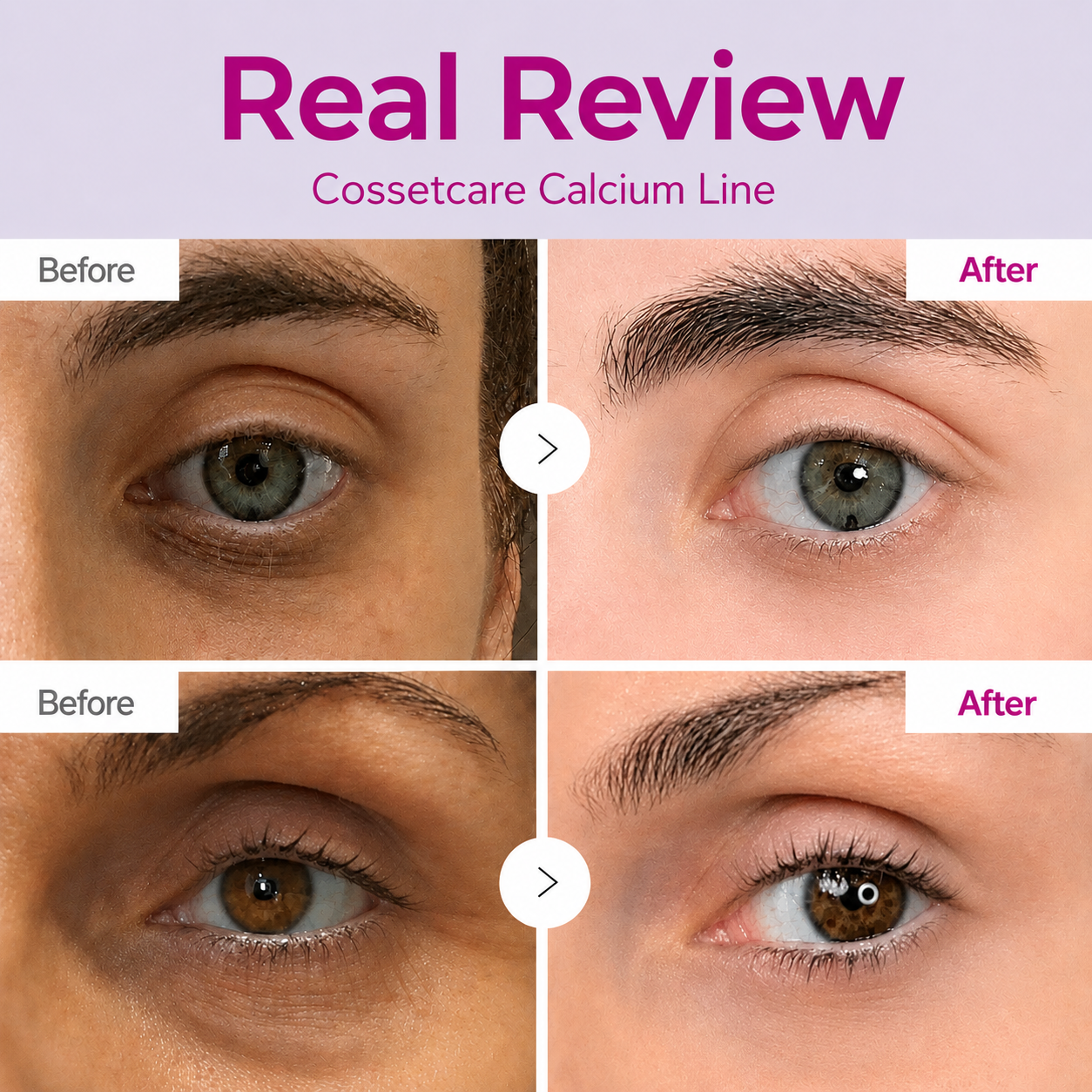 🔥LAST DAY 50% OFF!! Proserendipity Korean Calcium Dark Spot Eye Cream