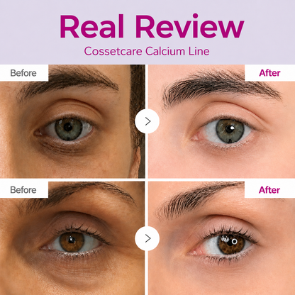 🔥LAST DAY 50% OFF!! Proserendipity Korean Calcium Dark Spot Eye Cream