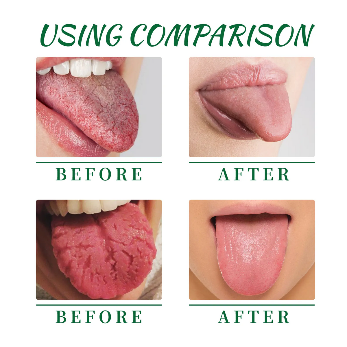 LOVILDS™ 𝙏𝙊𝙉𝙂𝙐𝙀 𝙍𝙀𝙋𝘼𝙄𝙍 𝑺𝒑𝒓𝒂𝒚 –🌈 Fix White Tongue & Bad Breath | Made in USA