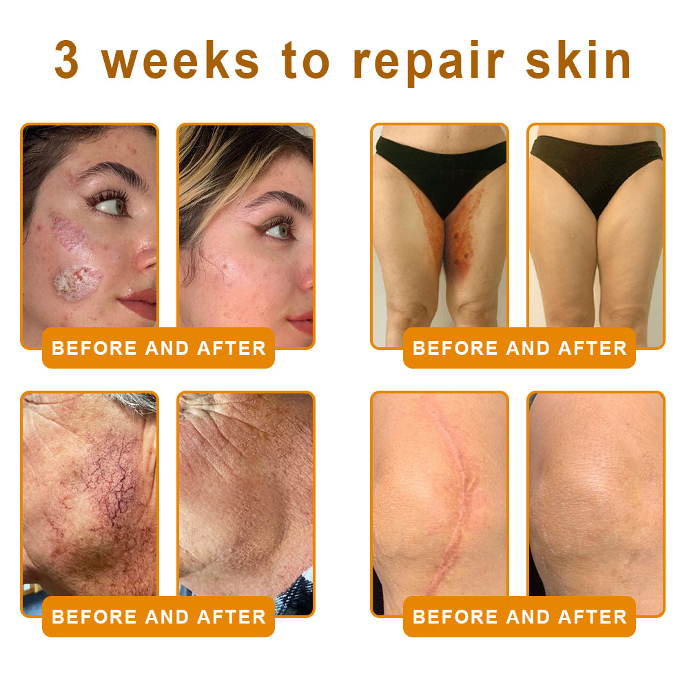 LOVILDS™ 𝘽𝙀𝙀 𝙑𝙀𝙉𝙊𝙈 𝑺𝒌𝒊𝒏 𝑹𝒆𝒔𝒕𝒐𝒓𝒂𝒕𝒊𝒐𝒏 𝑪𝒓𝒆𝒂𝒎 –🌸 Anti-Aging, Hydrating & Skin Repair