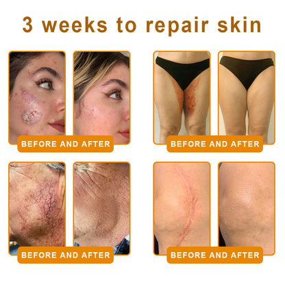 LOVILDS™ 𝘽𝙀𝙀 𝙑𝙀𝙉𝙊𝙈 𝑺𝒌𝒊𝒏 𝑹𝒆𝒔𝒕𝒐𝒓𝒂𝒕𝒊𝒐𝒏 𝑪𝒓𝒆𝒂𝒎 –🌸 Anti-Aging, Hydrating & Skin Repair