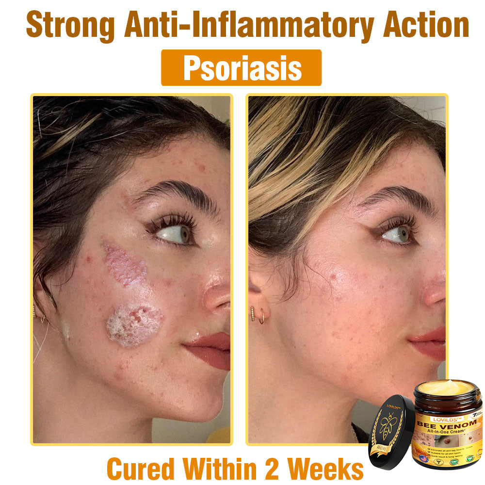 LOVILDS™ 𝘽𝙀𝙀 𝙑𝙀𝙉𝙊𝙈 𝑺𝒌𝒊𝒏 𝑹𝒆𝒔𝒕𝒐𝒓𝒂𝒕𝒊𝒐𝒏 𝑪𝒓𝒆𝒂𝒎 –🌸 Anti-Aging, Hydrating & Skin Repair
