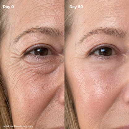 💖Trusted-by-over-50-000-women💖 Eye Renewal Cream