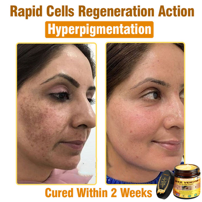 LOVILDS™ 𝘽𝙀𝙀 𝙑𝙀𝙉𝙊𝙈 𝑺𝒌𝒊𝒏 𝑹𝒆𝒔𝒕𝒐𝒓𝒂𝒕𝒊𝒐𝒏 𝑪𝒓𝒆𝒂𝒎 –🌸 Anti-Aging, Hydrating & Skin Repair