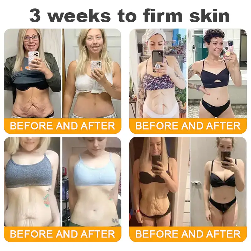 LOVILDS™ 𝘽𝙀𝙀 𝙑𝙀𝙉𝙊𝙈 𝑺𝒌𝒊𝒏 𝑹𝒆𝒔𝒕𝒐𝒓𝒂𝒕𝒊𝒐𝒏 𝑪𝒓𝒆𝒂𝒎 –🌸 Anti-Aging, Hydrating & Skin Repair