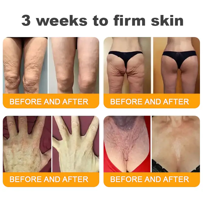 LOVILDS™ 𝘽𝙀𝙀 𝙑𝙀𝙉𝙊𝙈 𝑺𝒌𝒊𝒏 𝑹𝒆𝒔𝒕𝒐𝒓𝒂𝒕𝒊𝒐𝒏 𝑪𝒓𝒆𝒂𝒎 –🌸 Anti-Aging, Hydrating & Skin Repair