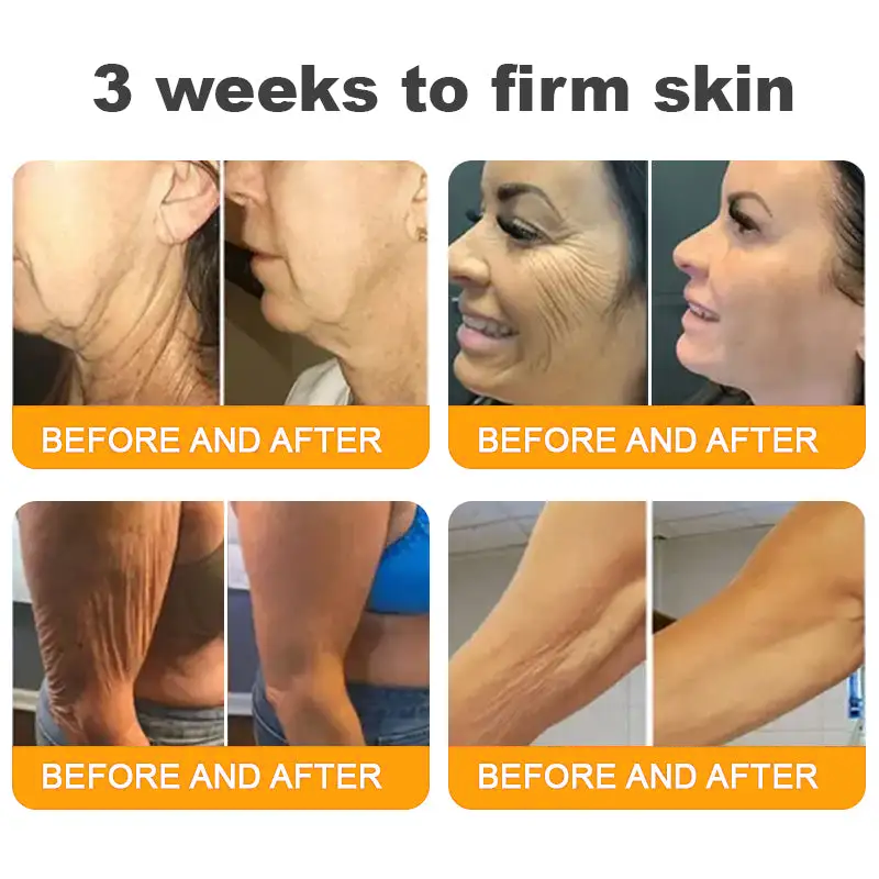 LOVILDS™ 𝘽𝙀𝙀 𝙑𝙀𝙉𝙊𝙈 𝑺𝒌𝒊𝒏 𝑹𝒆𝒔𝒕𝒐𝒓𝒂𝒕𝒊𝒐𝒏 𝑪𝒓𝒆𝒂𝒎 –🌸 Anti-Aging, Hydrating & Skin Repair