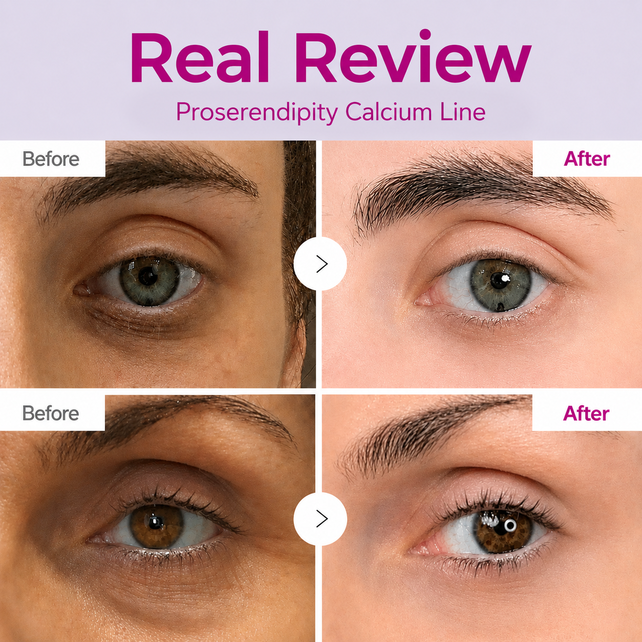 🔥LAST DAY 50% OFF!! Proserendipity Korean Calcium Dark Spot Eye Cream