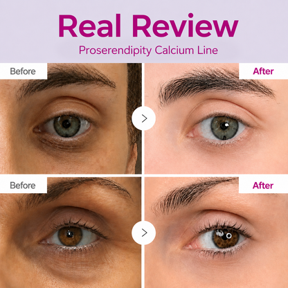 🔥LAST DAY 50% OFF!! Proserendipity Korean Calcium Dark Spot Eye Cream