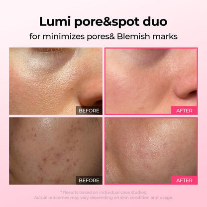 💥Shrinks Pores & Fades Blemish Marks in 2 Weeks | Cyano Pink Spicule Serum+ Picotonic Shot Ampoule