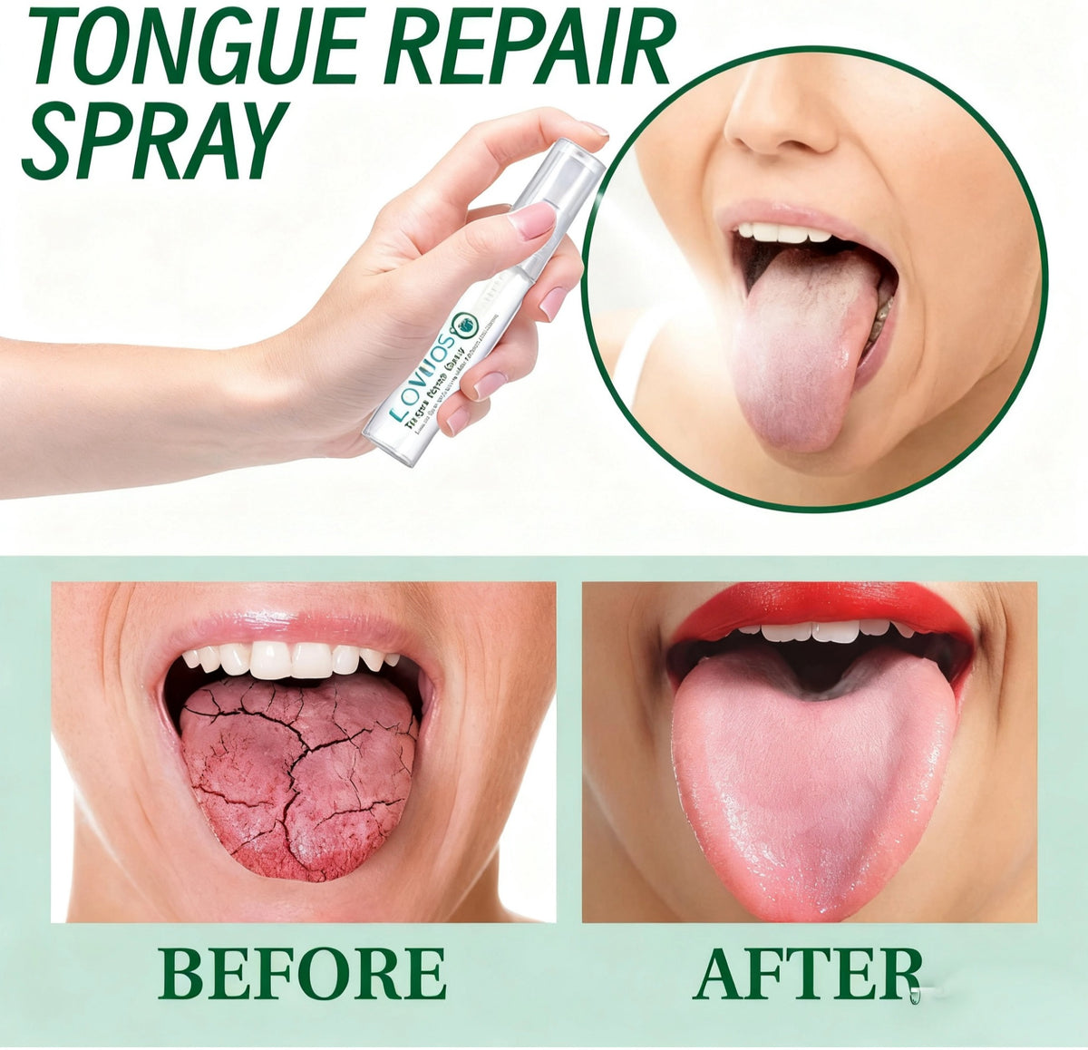 LOVILDS™ 𝙏𝙊𝙉𝙂𝙐𝙀 𝙍𝙀𝙋𝘼𝙄𝙍 𝑺𝒑𝒓𝒂𝒚 –🌈 Fix White Tongue & Bad Breath | Made in USA